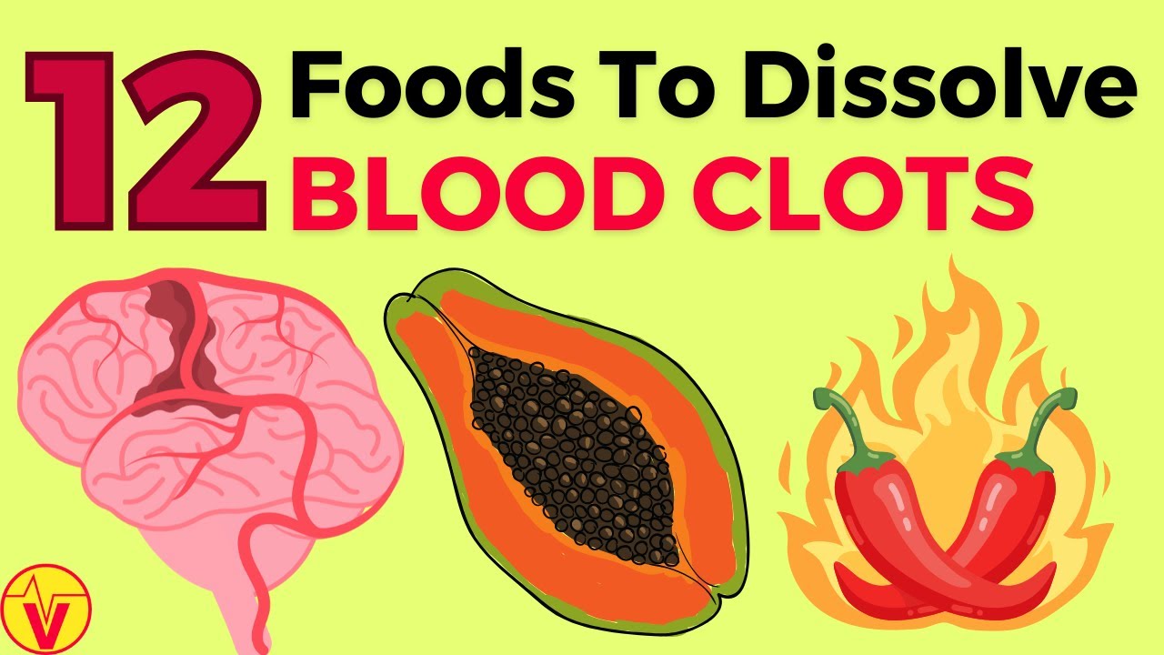 Effective Ways to Dissolve Blood Clots Naturally in 2025: Improve Your Health Today!