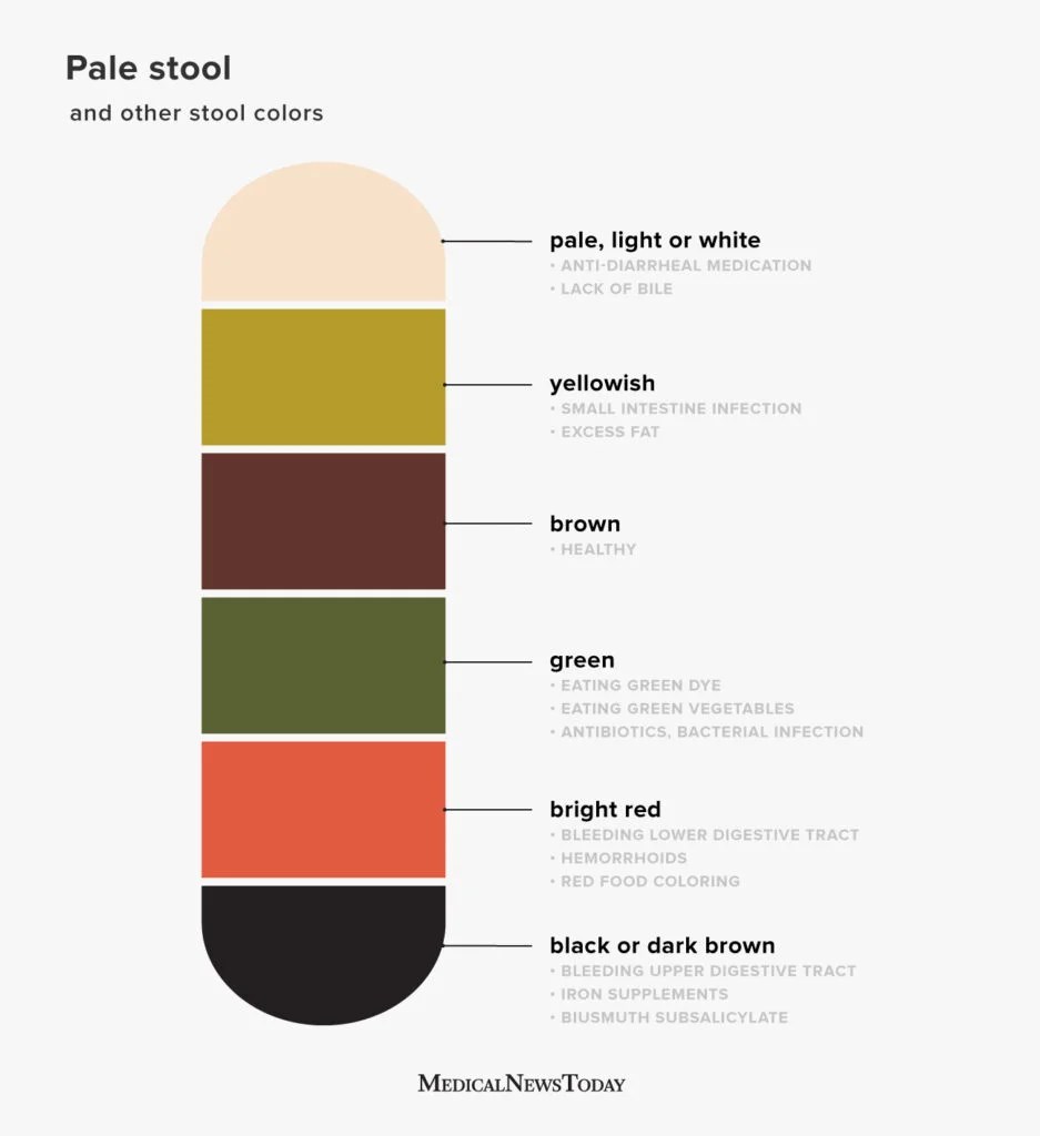 Understanding Yellow Poop