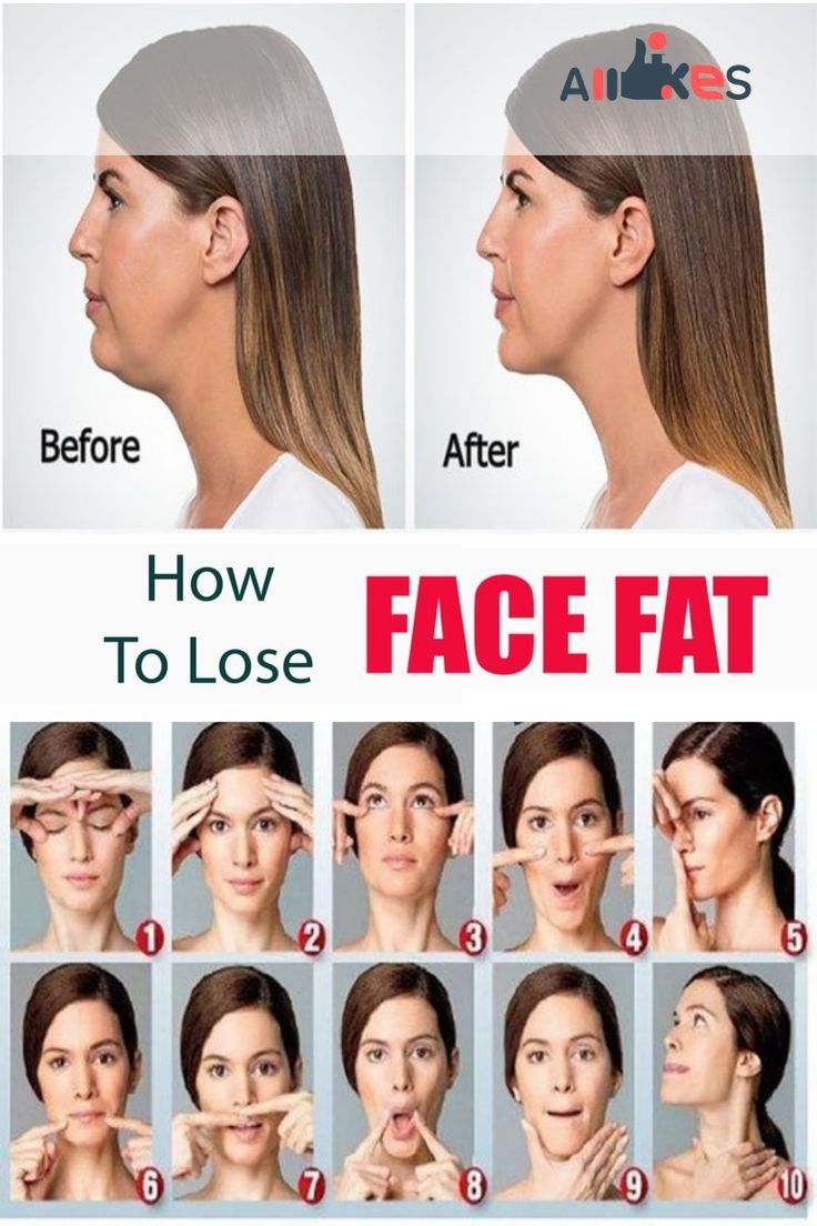 How to Effectively Reduce Face Fat: Proven Tips for a Slimmer Look in 2025